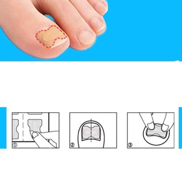 ПАТЧИ ДЛЯ ВРАСТНЫХ НОГТЕЙ ПАТЧИ 48 ШТ.