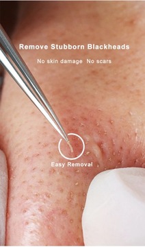 Немецкий сверхтонкий №. 5-клеточный пинцет от прыщей, черных точек, салон красоты