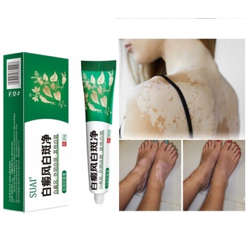 EELHOE Krem na bielactwo 50ml krem psoralen