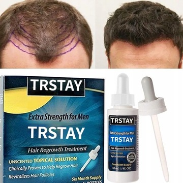 New Hair Regrowth Oil Essential Oils Essence