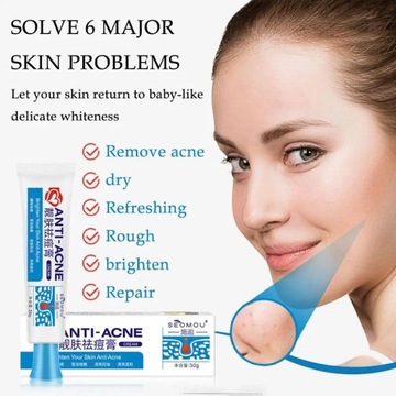 30 г мощного крема для лица от прыщей, удаляющего прыщи