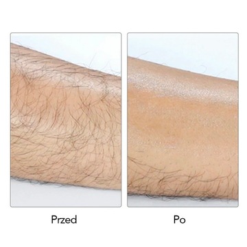 CRYSTAL DEPILATOR ЭПИЛЯТОР ДЛЯ УДАЛЕНИЯ ВОЛОС синий