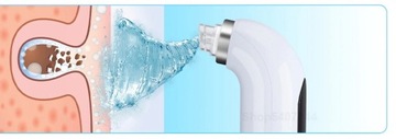 Гидрабразия МИКРОДЕРМАБРАЗИЯ Вода ПЫЛЕСОС