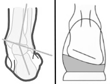 Стельки супинирующие ортопедические Memo серые - №24