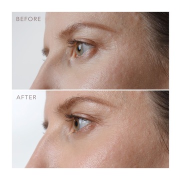 FOREO IRIS Укрепляющая ночная сыворотка для глаз