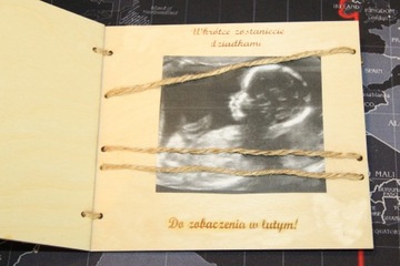 Сувенирная рамка для УЗИ на беременность Подарок бабушкам и дедушкам