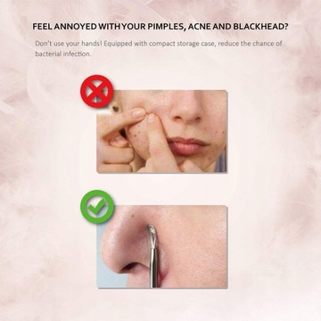 НАБОР ЛОЖЕК UNA ДЛЯ УДАЛЕНИЯ БЛЭКХОТОВ