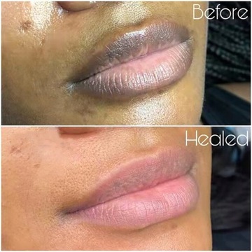 Осветляющий отбеливающий крем-эксфолиатор