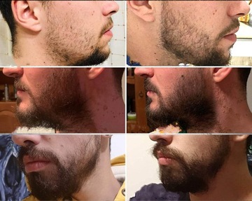 ВАЛИК ДЛЯ БОРОДЫ DERMA ВАЛИЦ ДЛЯ УСОВ