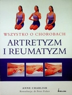 Artretyzm i reumatyzm Wszystko o chorobach