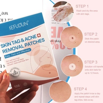 Инструмент для удаления пятен от прыщей