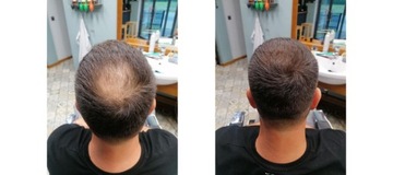 Kmax Microfibers для утолщения волос, 32 г, 100% натуральный кератин, ЧЕРНЫЙ