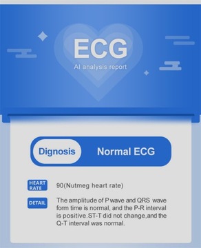 Умные часы Монитор сердечного ритма и артериального давления