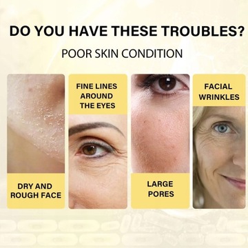 Впитывающая коллагеновая нить для подтяжки лица.