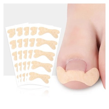 5 X PLASTRY NA WRASTAJĄCE PAZNOKCIE KLAMRA PASKI