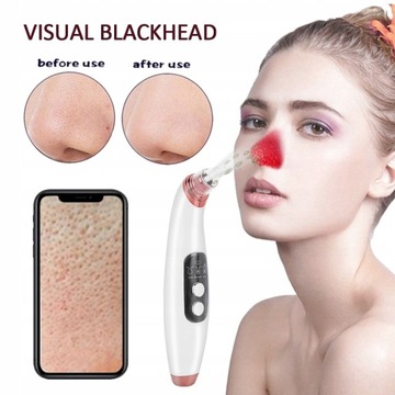 Blackhead Remover Kit Face Skin Vacuum Pore