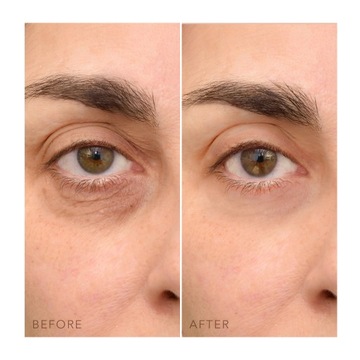 KREM ROZJAŚNIAJĄCY OCZY IRIS Z WITAMINĄ C