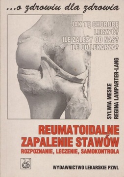 Reumatoidalne zapalenie stawów Sylwia Meske