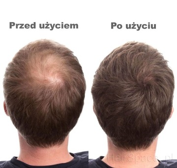 Новый пакетик косметики для густоты волос СЕВИЧ