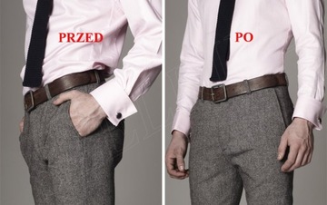 Подтяжки, чтобы держать рубашку и носки