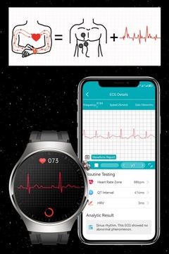 Zegarek KARDIOWATCH z Pomiarem Glukozy EKG Skład Krwi Ciśnienie PULS AMOLED