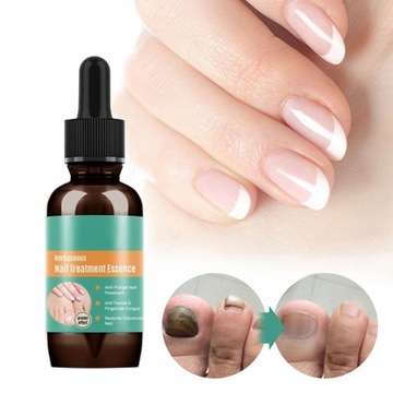 PREPARAT DO USUWANIA GRZYBICY PAZNOKCI 30ML