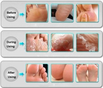 базовые отшелушивающие носки для ног