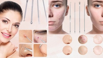 ŁYŻECZKI UNY DO USUWANIA WĄGRÓW ZASKÓRNIKÓW DWUSTRONNE SONDA PODOLOGICZNA