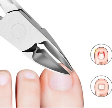 CĄŻKI OBCINACZ DO WRASTAJĄCYCH PAZNOKCI GRUBYCH TWARDYCH DLA SENIORÓW DUŻY