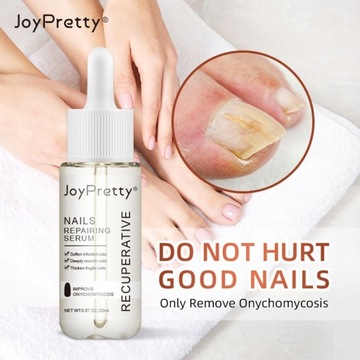 Грибок ногтей Strong Nail Repair Liquid