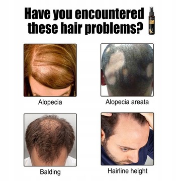 Питательное решение для защиты от выпадения волос