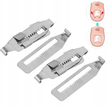 ЗАЖИМЫ ДЛЯ КОРРЕКТОРА ВРОСШИХ НОГТЕЙ, 2 ШТ.