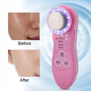 Аппарат для омоложения кожи лица 5 в 1.