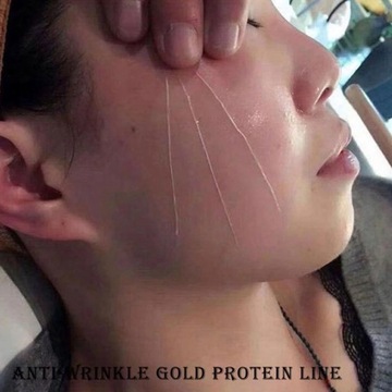 БЕЛКО-КОЛАГЕНОВЫЕ ЛИФТИНГОВЫЕ НИТИ 12 ШТ.