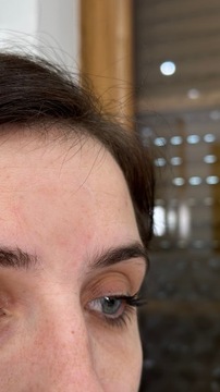 Skinremide Патчи от морщин для лица, треугольной формы, 160 шт.