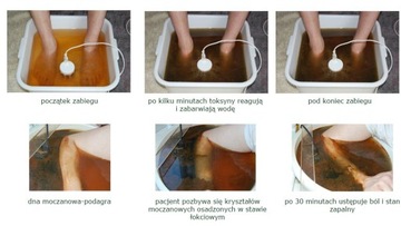 Детокс тела Очищение тела Чаша для очищения тела Gateway Detox