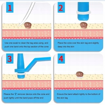 Набор для удаления меток кожи — 10 полосок
