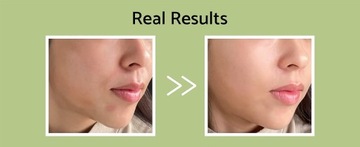 USPOKAJAJĄCY KREM-ŻEL CENTELLA ASIATICA - NAWILŻENIE I NAWODNIENIE-60ML