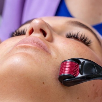 Derma Roller do twarzy do mezoterapii mikroigłowej igłowa rolka dermaroller