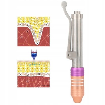 Ручка для инъекций гиалуроновой кислоты 7 см yi6eg