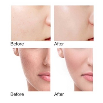 50g LANBENA VITAMIN C CREAM Moisturizing For Face