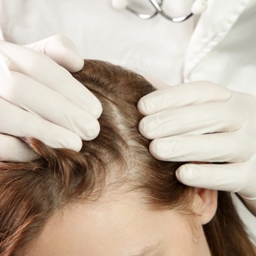 PEELING ENZYMATYCZNY DO SKÓRY GŁOWY OCZYSZCZAJĄCY TRYCHOLOGICZNY BIONIGREE