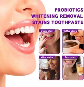 2 шт. Ультра отбеливающая зубная паста SP-6, отбеливающая зубная паста с пробиотиками SP-6