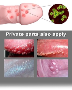 АПТЕО ЗАЩИТНАЯ МАЗЬ С ВИТАМИНОМ А 30Г