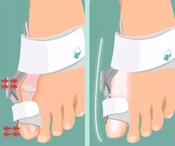 АКТИВНЫЙ КОРРЕКЦИОН ДЛЯ Ортеза HALLUX PRO корсет