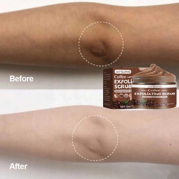 JAYSUING Whitening Peeling удаляет омертвевшую кожу