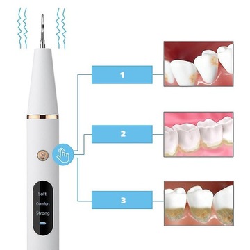 УЛЬТРАЗВУКОВОЙ СТОМАТОЛОГИЧЕСКИЙ СКАЛЕНЕР ДЛЯ МОЩНОГО УДАЛЕНИЯ НАКИПИ С ЗУБОВ