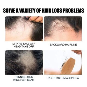 Масло для роста волос, быстро восстанавливающее средство против облысения