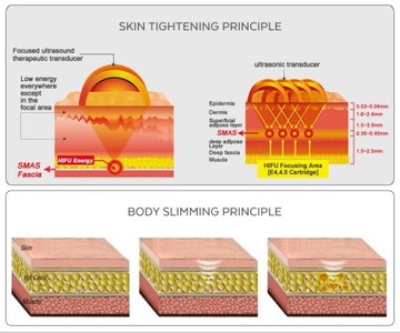 HIFU Ультразвуковой уход за кожей лица против морщин Красота