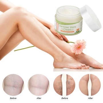 Крем от варикозного расширения вен, увлажняющий кровеносные сосуды 50г